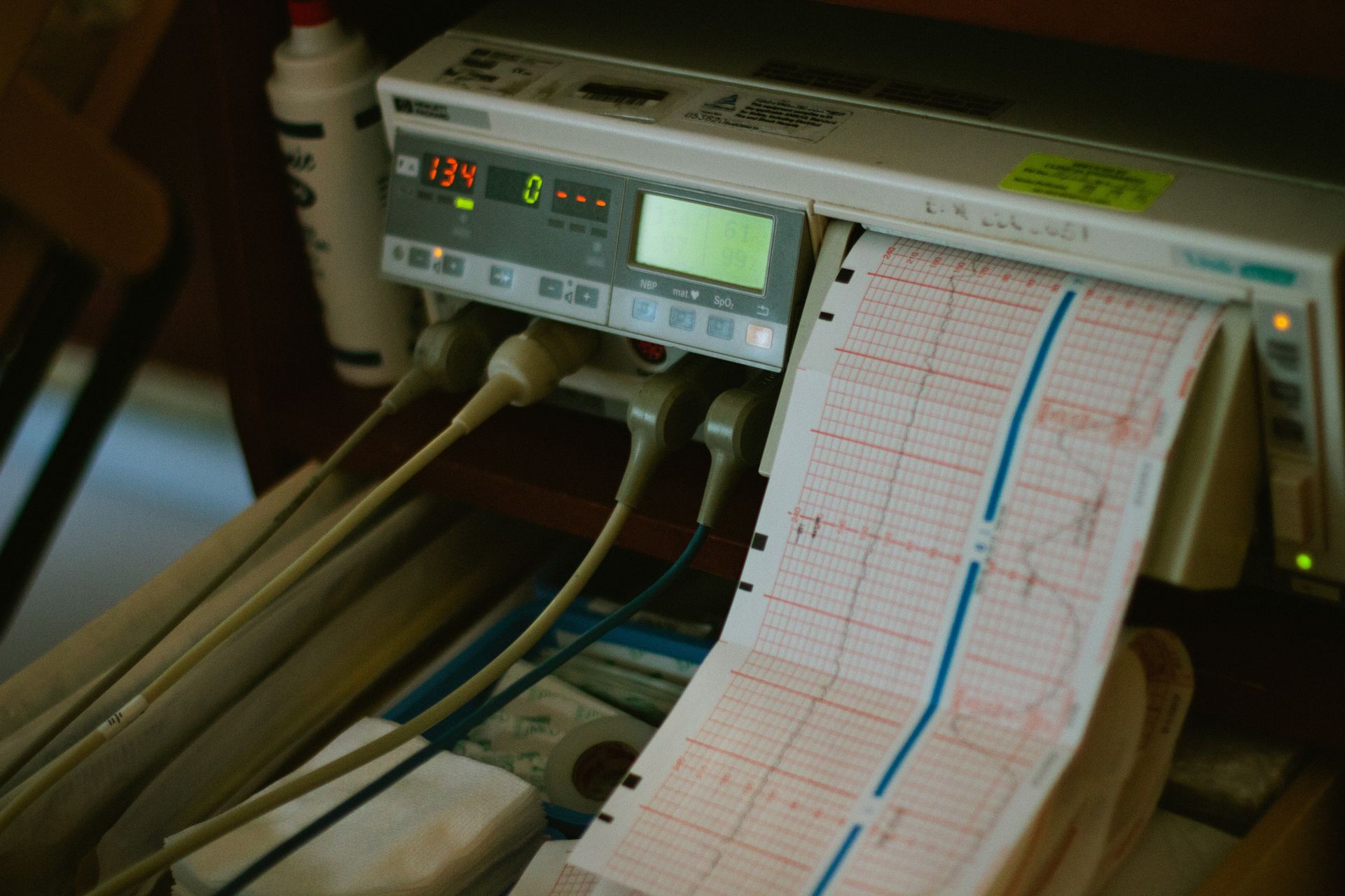 What Is a Stress Echo Test? | NDS Wellness